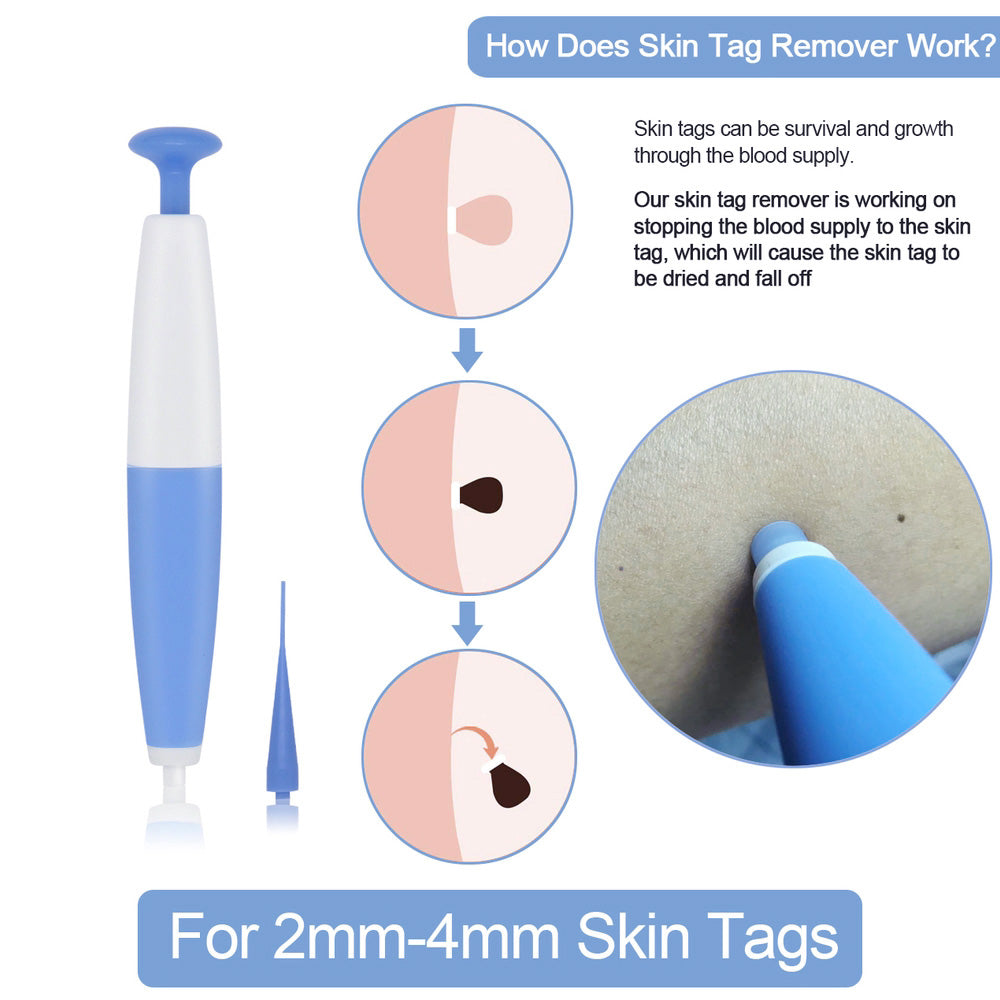 Skin Tag Removal Kit