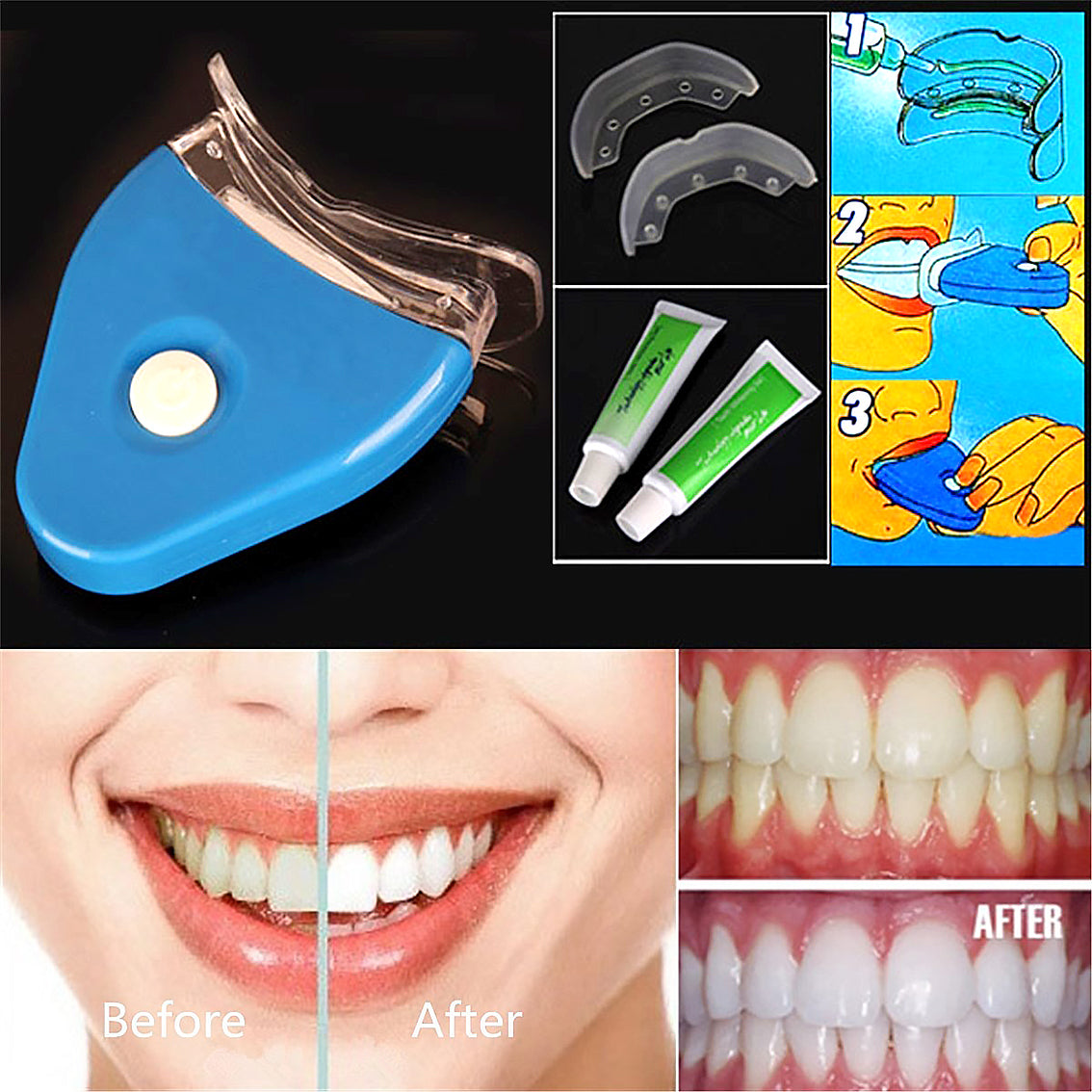 Oral Gel Teeth Whitener